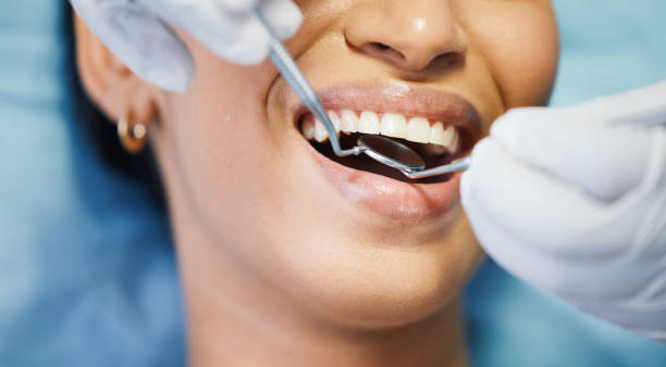 Best Chipped Tooth Repair Near Me  in South Tucson, AZ
